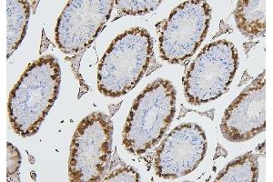 IHC analysis of CDK1 using anti-CDK1 antibody (ABIN7602240). (CDK1 抗体  (AA 66-297))