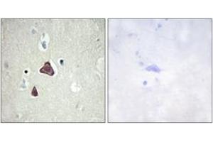 Immunohistochemistry analysis of paraffin-embedded human brain tissue, using ADCY8 Antibody.