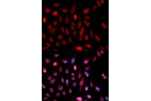 Immunofluorescence analysis of U2OS cells using ASH2L antibody (ABIN5973125). (ASH2L 抗体)