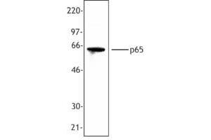 Image no. 1 for anti-Nuclear Factor-kB p65 (NFkBP65) (C-Term) antibody (ABIN230593) (NF-kB p65 抗体  (C-Term))