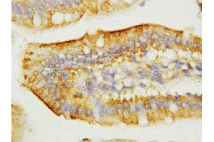 Anti-EGF antibody, IHC(P) IHC(P): Mouse Intestine Tissue (EGF 抗体  (C-Term))