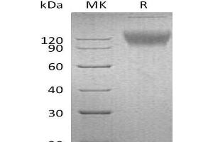 Western Blotting (WB) image for Signal-Regulatory Protein alpha (SIRPA) protein (Fc Tag) (ABIN7320647)