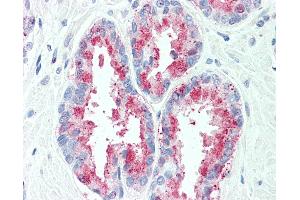 Anti-TSPAN13 antibody IHC of human, prostate. (TSPAN13 抗体  (Internal Region))