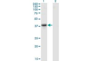 Western Blotting (WB) image for anti-serpin Peptidase Inhibitor, Clade B (Ovalbumin), Member 10 (SERPINB10) (AA 46-145) antibody (ABIN1774812)