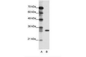 Image no. 1 for anti-Ts Translation Elongation Factor, Mitochondrial (TSFM) (C-Term) antibody (ABIN202296) (TSFM 抗体  (C-Term))
