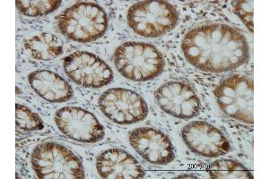Immunoperoxidase of monoclonal antibody to AKT1 on formalin-fixed paraffin-embedded human colon. (AKT1 抗体  (AA 1-480))