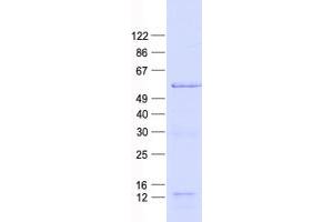 Western Blotting (WB) image for Activating Transcription Factor 2 (ATF2) protein (His tag) (ABIN2715020)