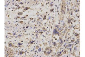 Immunohistochemistry (IHC) image for anti-GDP Dissociation Inhibitor 1 (GDI1) antibody (ABIN1876650) (GDI1 抗体)