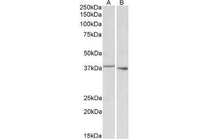 AP22434PU-N PCBP1 antibody staining of Rat Spleen (A) and Thymus (B) lysate at 0. (PCBP1 抗体  (Internal Region))