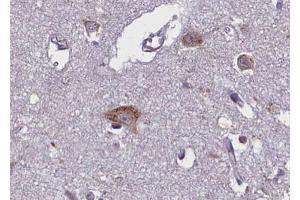 Immunohistochemistry (IHC) image for anti-Neurotrophic Tyrosine Kinase, Receptor, Type 2 (NTRK2) (pTyr706) antibody (ABIN6255997)