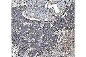 IHC analysis of REA/PHB2 using anti-REA/PHB2 antibody (ABIN7599239). (Prohibitin 2 抗体  (AA 1-299))