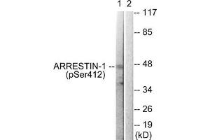 Western blot analysis of extracts from COS7 cells treated with Etoposide using Arrestin 1 (Phospho-Ser412) Antibody. (beta Arrestin 1 抗体  (pSer412))