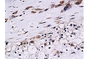Formalin-fixed and paraffin embedded human placenta labeled with Anti-Cystatin B Polyclonal Antibody, Unconjugated (ABIN755692) at 1:200 followed by conjugation to the secondary antibody and DAB staining (CSTB 抗体  (AA 51-98))