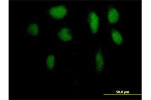 Immunofluorescence of purified MaxPab antibody to ZFP95 on HeLa cell. (ZKSCAN5 抗体  (AA 1-839))