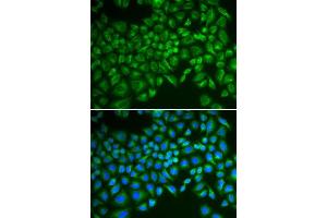 Immunofluorescence (IF) image for anti-Selectin E (SELE) (AA 22-230) antibody (ABIN3023172)