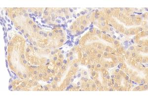 Detection of HSPBP1 in Mouse Kidney Tissue using Polyclonal Antibody to Heat Shock 70 kDa Binding Protein 1 (HSPBP1) (HSPBP1 抗体  (AA 209-354))