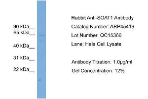 WB Suggested Anti-SOAT1  Antibody Titration: 0.
