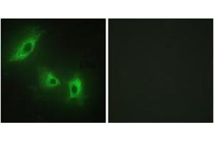Immunofluorescence analysis of HeLa cells, using ACV1B Antibody. (Activin A Receptor Type IB/ALK-4 抗体  (AA 73-122))