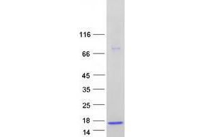Western Blotting (WB) image for Additional Sex Combs Like 1 (ASXL1) protein (Myc-DYKDDDDK Tag) (ABIN2714399)