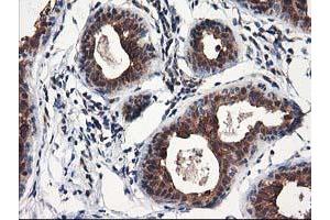Immunohistochemical staining of paraffin-embedded Human breast tissue using anti-NUDT18 mouse monoclonal antibody. (NUDT18 抗体)