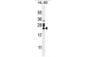 CSF2 Antibody (Center) western blot analysis in HL60 cell line lysates (35µg/lane). (GM-CSF 抗体  (Middle Region))