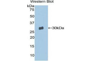 Western Blotting (WB) image for anti-Moesin (MSN) (AA 354-577) antibody (ABIN1859889) (Moesin 抗体  (AA 354-577))