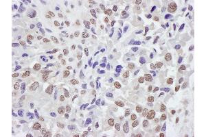 Immunohistochemistry (IHC) image for anti-Tripartite Motif Containing 33 (TRIM33) (AA 650-700) antibody (ABIN7453470) (TRIM33 抗体  (AA 650-700))