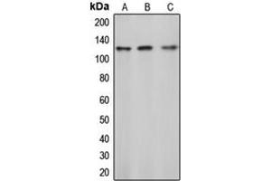 Western blot analysis of c-CBL (pY774) expression in Jurkat (A), mouse liver (B), rat liver (C) whole cell lysates. (CBL 抗体  (C-Term, pTyr774))