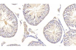 Detection of NSE in Mouse Testis Tissue using Polyclonal Antibody to Enolase, Neuron Specific (NSE) (ENO2/NSE 抗体  (AA 2-434))