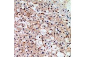 Immunohistochemical analysis of MIA2 staining in human liver formalin fixed paraffin embedded tissue section.
