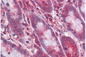 Human Small Intestine: Formalin-Fixed, Paraffin-Embedded (FFPE) (OCA2 抗体  (AA 468-517))