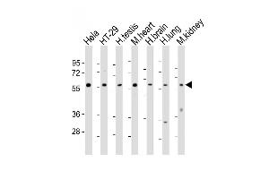 All lanes : Anti-ETV1 Antibody (C-Term) at 1:2000 dilution Lane 1: Hela whole cell lysates Lane 2: HT-29 whole cell lysates Lane 3: human testis lysates Lane 4: mouse heart lysates Lane 5: human brain lysates Lane 6: human lung lysates Lane 7: mouse kidney lysates Lysates/proteins at 20 μg per lane. (ETV1 抗体  (AA 434-465))