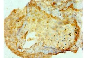 Immunohistochemistry of paraffin-embedded human testis tissue using ABIN7144327 at dilution of 1:100 (AMHR2 抗体  (AA 18-149))