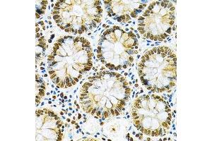 Immunohistochemistry of paraffin-embedded human colon using HNRNPA2B1 Antibody. (HNRNPA2B1 抗体  (AA 1-180))