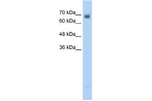 WB Suggested Anti-CRMP1 Antibody Titration:  0. (CRMP1 抗体  (N-Term))