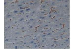 IHC-P analysis of Human Liver Tissue, with DAB staining. (Iba1 抗体  (AA 1-147))
