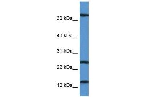 Western Blot showing TARP antibody used at a concentration of 1 ug/ml against Jurkat Cell Lysate (TARP 抗体  (N-Term))