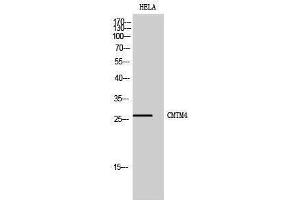 Western Blotting (WB) image for anti-CKLF-Like MARVEL Transmembrane Domain Containing 4 (CMTM4) (Internal Region) antibody (ABIN3174457) (CMTM4 抗体  (Internal Region))
