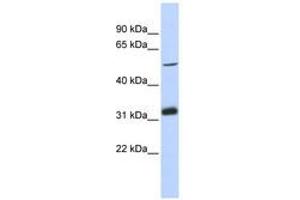 Image no. 1 for anti-Tandem C2 Domains, Nuclear (TC2N) (AA 251-300) antibody (ABIN6741190) (TC2N 抗体  (AA 251-300))