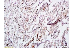 Formalin-fixed and paraffin embedded rat skin tissue labeled with Anti VEGF Polyclonal Antibody,Unconjugated (ABIN674829) at 1:600 followed by conjugation to the secondary antibody and DAB staining.