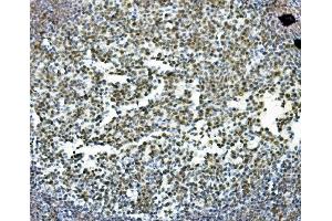 IHC analysis of PRDM5 using anti-PRDM5 antibody (ABIN7600853). (PRDM5 抗体  (AA 24-630))