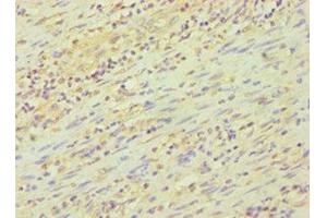 Immunohistochemistry of paraffin-embedded human epityphlon tissue using ABIN7162842 at dilution of 1:100 (FKBP4 抗体  (AA 220-459))