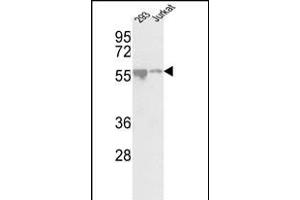 Western blot analysis of CDKL2 Center (ABIN391189 and ABIN2841281) in 293, Jurkat cell line lysates (35 μg/lane). (CDKL2 抗体  (AA 226-255))