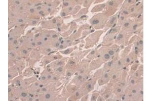 DAB staining on IHC-P; Samples: Human Liver Tissue (HFE2 抗体  (AA 234-416))