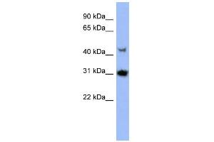 WB Suggested Anti-PRKY Antibody Titration: 0. (PRKY 抗体  (N-Term))