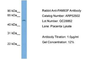 WB Suggested Anti-FAM83F  Antibody Titration: 0. (FAM83F 抗体  (N-Term))