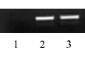 Histone H4 acetyl Lys5 antibody tested by ChIP analysis. (Histone H4 抗体  (acLys5))