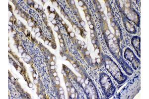 IHC analysis of Xanthine Oxidase using anti-Xanthine Oxidase antibody . (XDH 抗体  (AA 2-343))