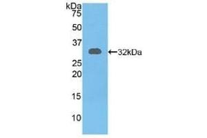 Detection of Recombinant RYK, Mouse using Polyclonal Antibody to Related To Receptor Tyrosine Kinase (RYK) (RYK 抗体  (AA 287-533))