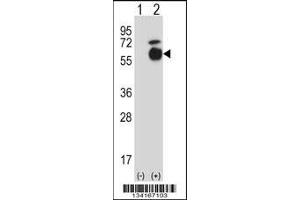 Western blot analysis of Acvr1 using rabbit polyclonal Mouse Acvr1 Antibody using 293 cell lysates (2 ug/lane) either nontransfected (Lane 1) or transiently transfected (Lane 2) with the Acvr1 gene.